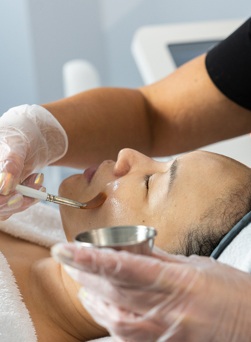 What is the Difference Between a Light, Medium, and Deep Chemical Peel?
