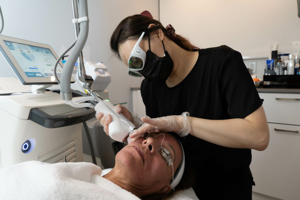 Halo Laser Treatment-skin texture resurfacing-wrinkles and fine lines, sun damage and pigmented lesions, actinic keratoses, scars, laxity, and enlarged pores