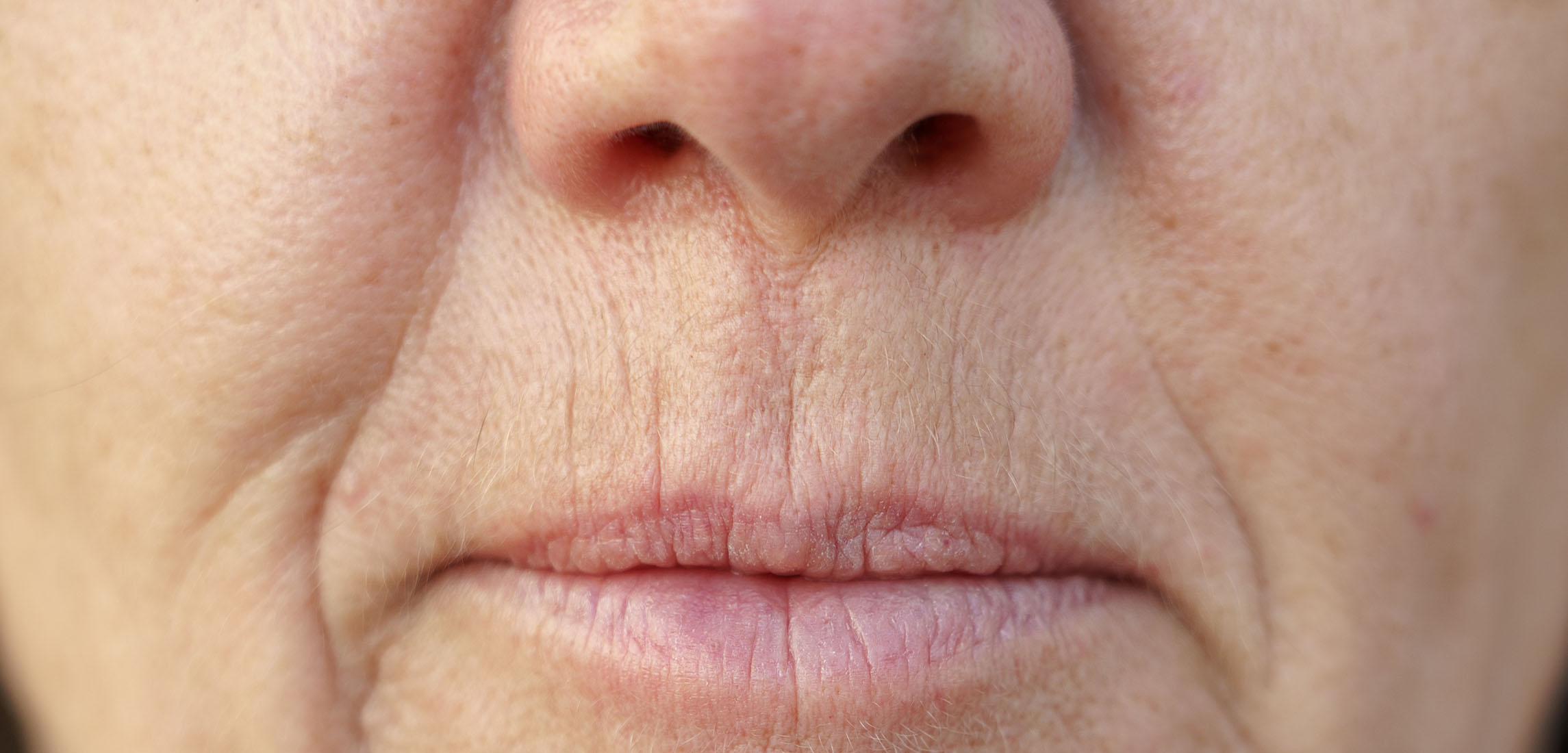 Ugly Close Pursed Lips Harsh Light Stock Photo 769790566 | Shutterstock